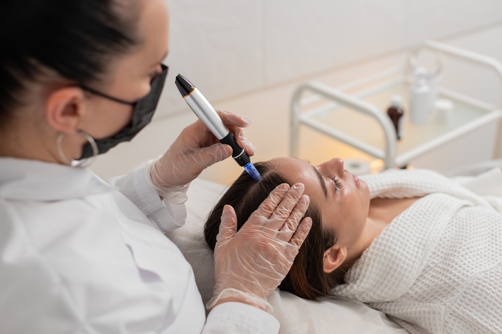 Haargroei stimulatie behandeling in Hoorn