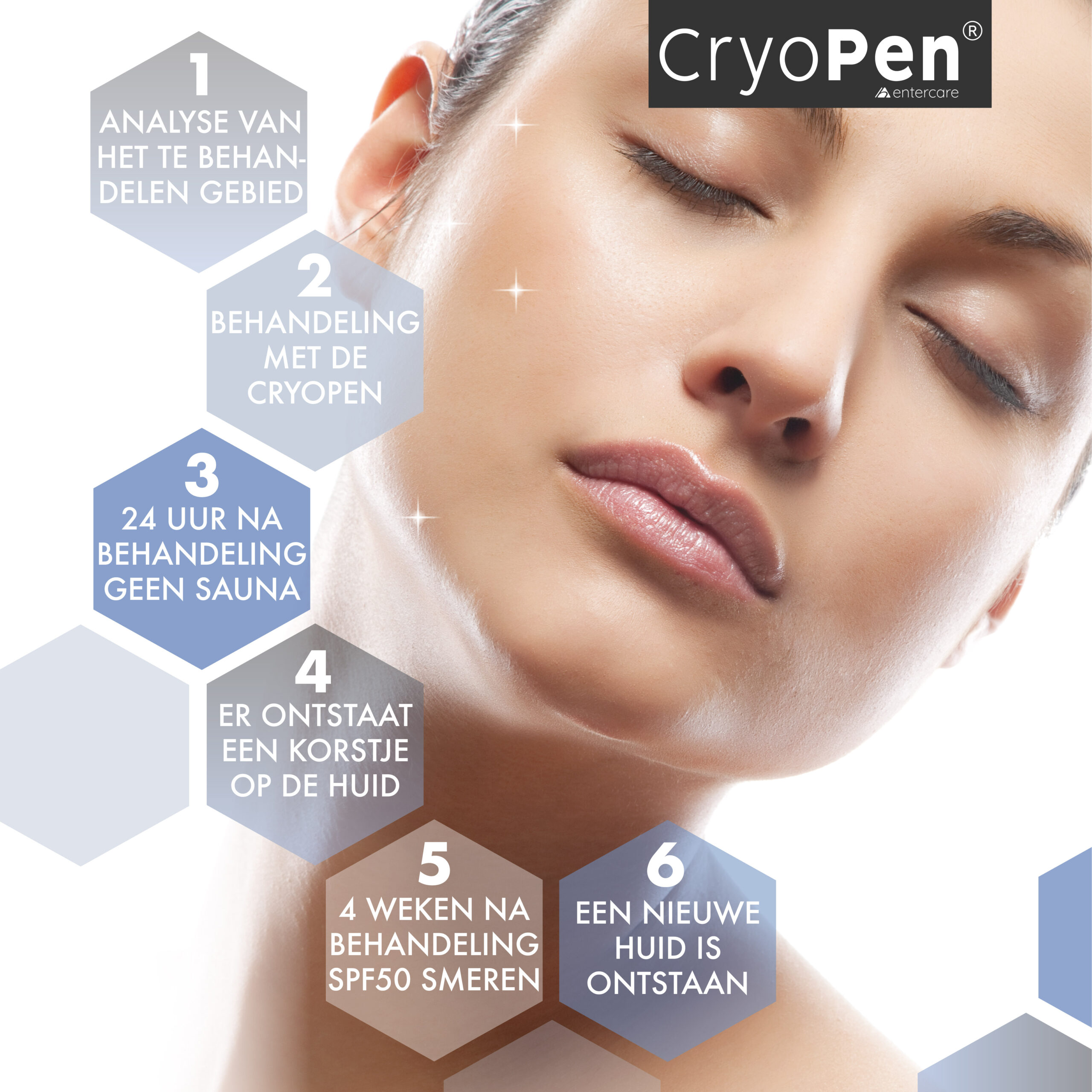 CryoPen behandeling in Hoorn