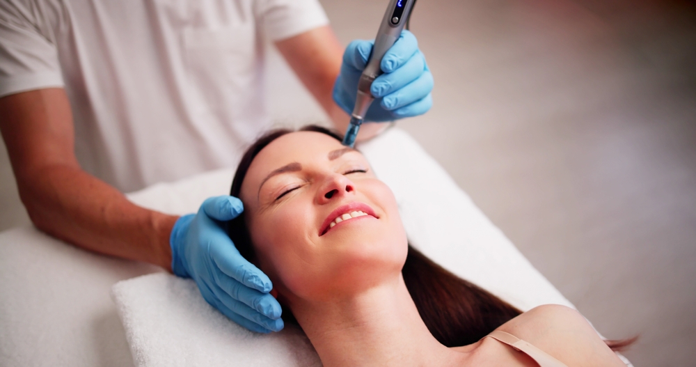 Microneedling behandeling