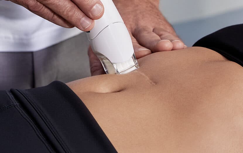 LPG Endermologie Medical behandeling in Hoorn